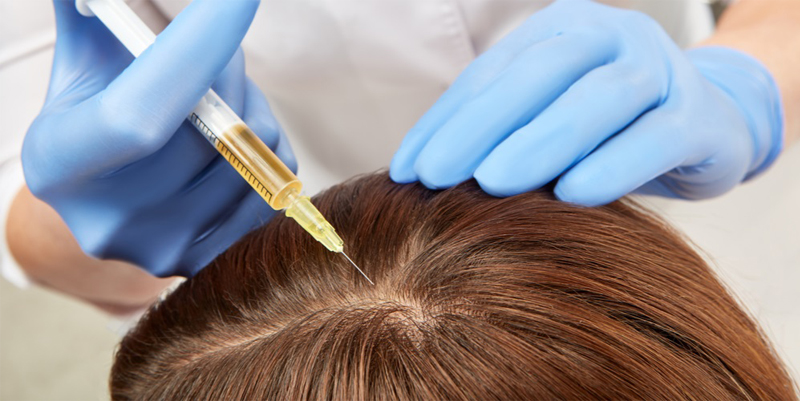 Plasma Injections for regrow hair